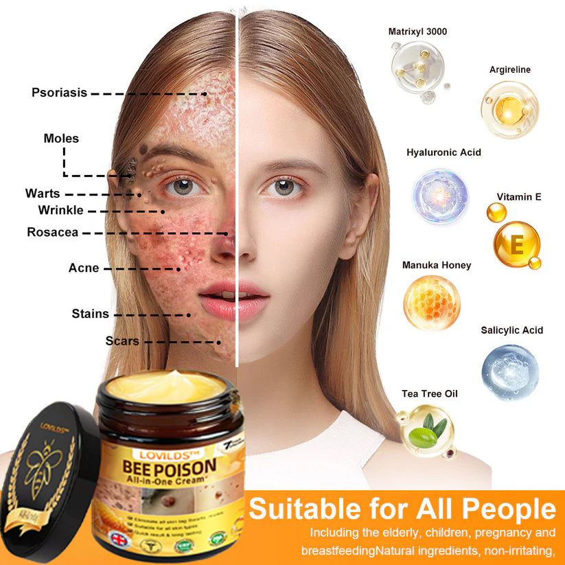 🐝[Official Brand Store] 🐝 LOVILDS™ Bee Venom All-In-One Cream (👩‍⚕️British Association of Dermatology 2025 Special Recommendation)