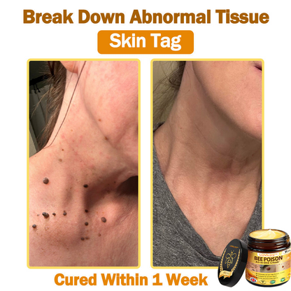 🐝[Official Brand Store] 🐝 LOVILDS™ Bee Venom All-In-One Cream (👩‍⚕️British Association of Dermatology 2025 Special Recommendation)