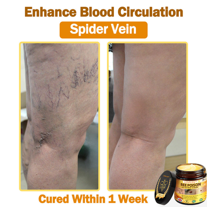 🐝[Official Brand Store] 🐝 LOVILDS™ Bee Venom All-In-One Cream (👩‍⚕️British Association of Dermatology 2025 Special Recommendation)