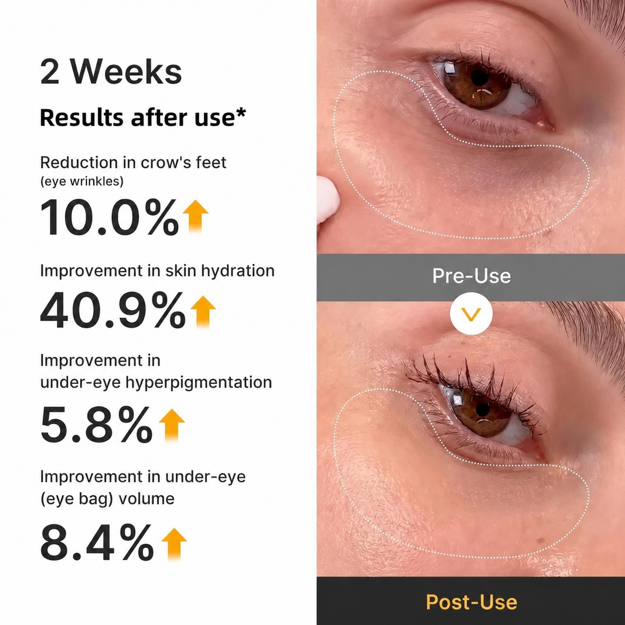 Kojic Acid Turmeric Vita Jelly Eye Mask