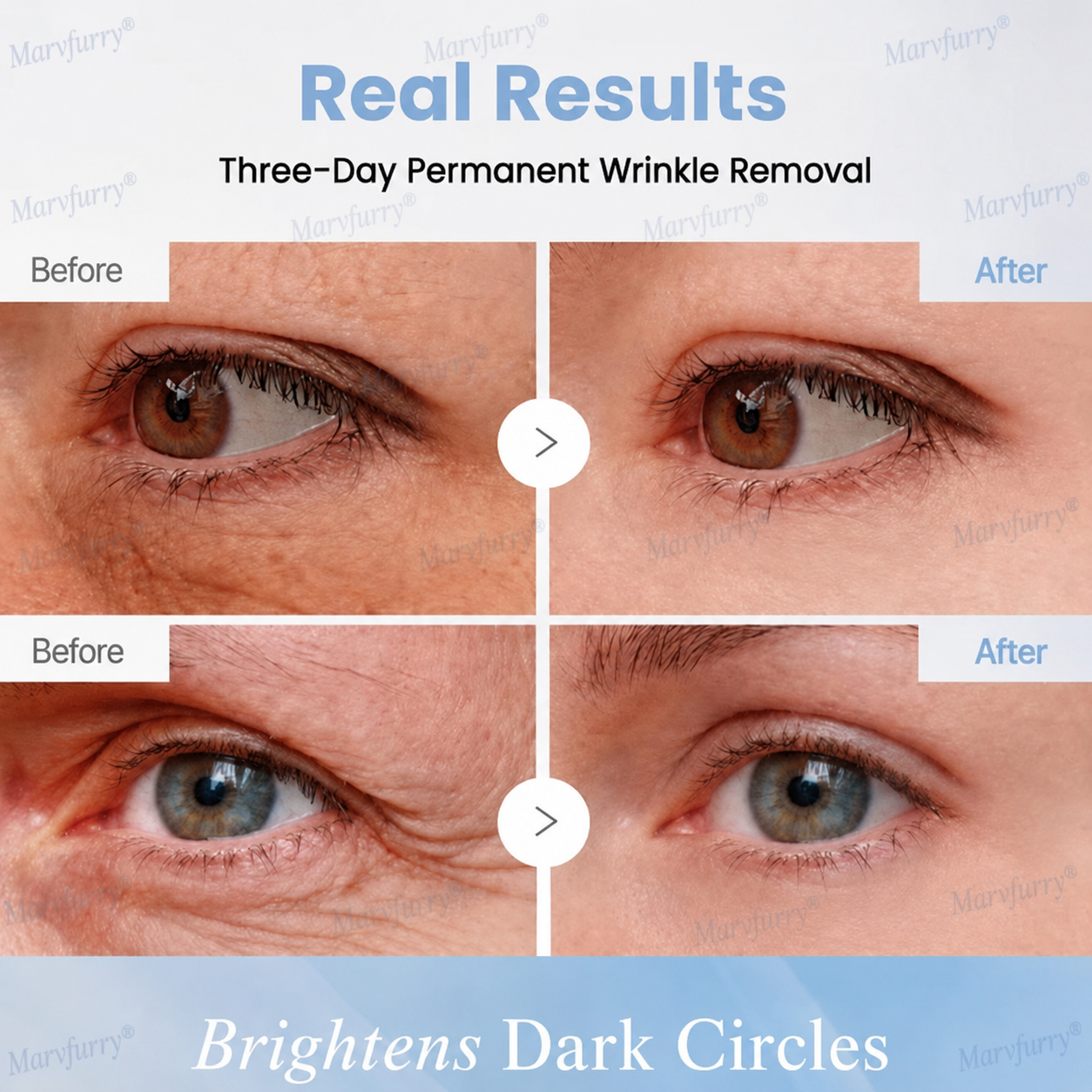 🌐🥇🛒Marvfurry® PDRN Anti-Wrinkle Shot – Lift & Firming Cream