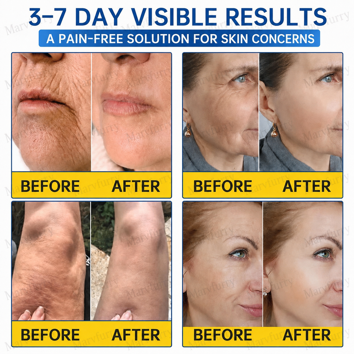 🌐🥇🛒Marvfurry® PDRN Anti-Wrinkle Shot – Lift & Firming Cream