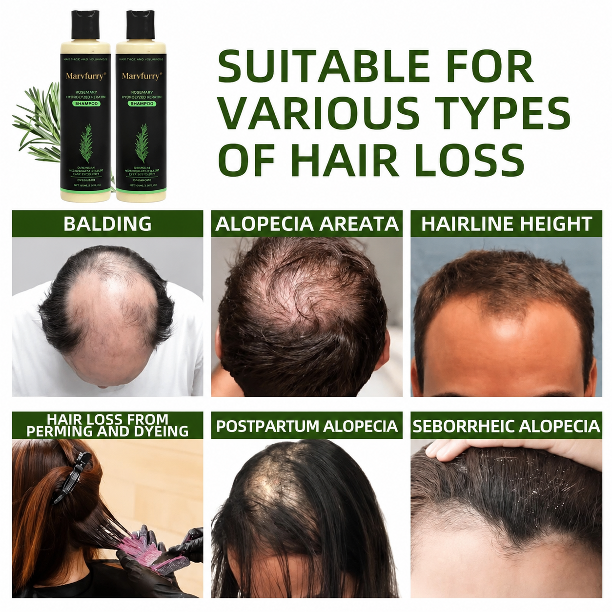 🌱 Organic Rosemary Hair Growth Shampoo