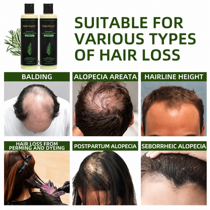 🌱 Organic Rosemary Hair Growth Shampoo